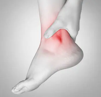 Посттравматический синовит: когда после ушиба сустав продолжает болеть и опухать